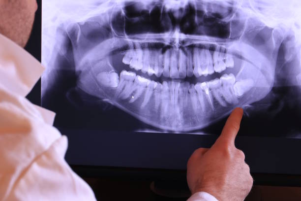 Best Emergency Tooth Extraction in Happy Valley, CA
