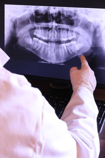 Best Emergency Tooth Extraction in Happy Valley, CA